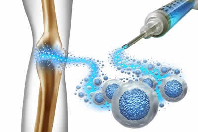 human cellular tissue